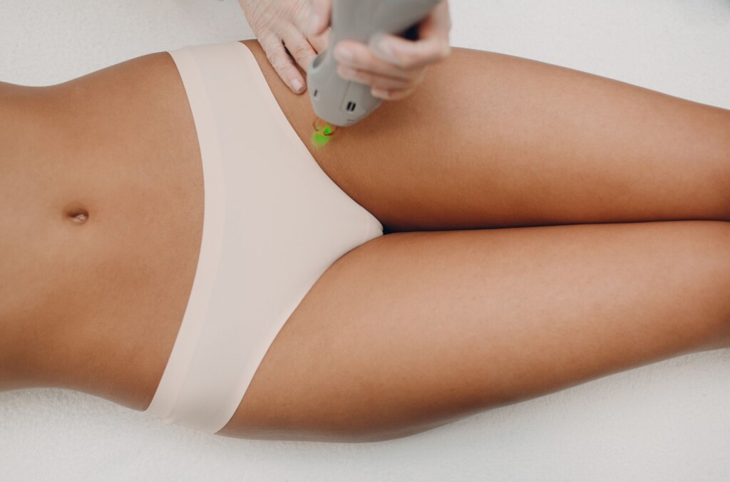 Bikini laser hair removal